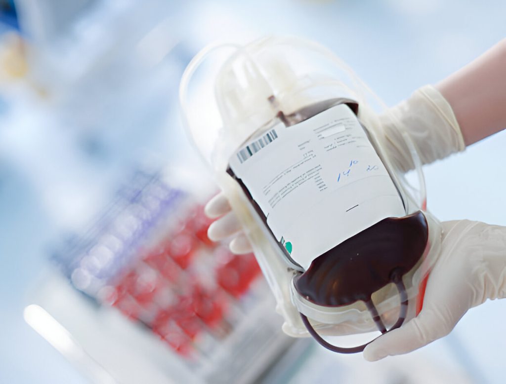 Blood Bags: Essential Tools for Blood Collection, Storage, and Transfusion