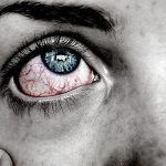 food sensitivity symptoms
