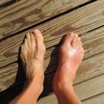 hereditary health conditions