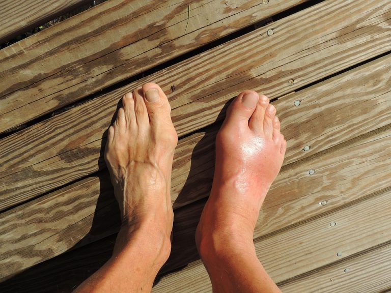 hereditary health conditions